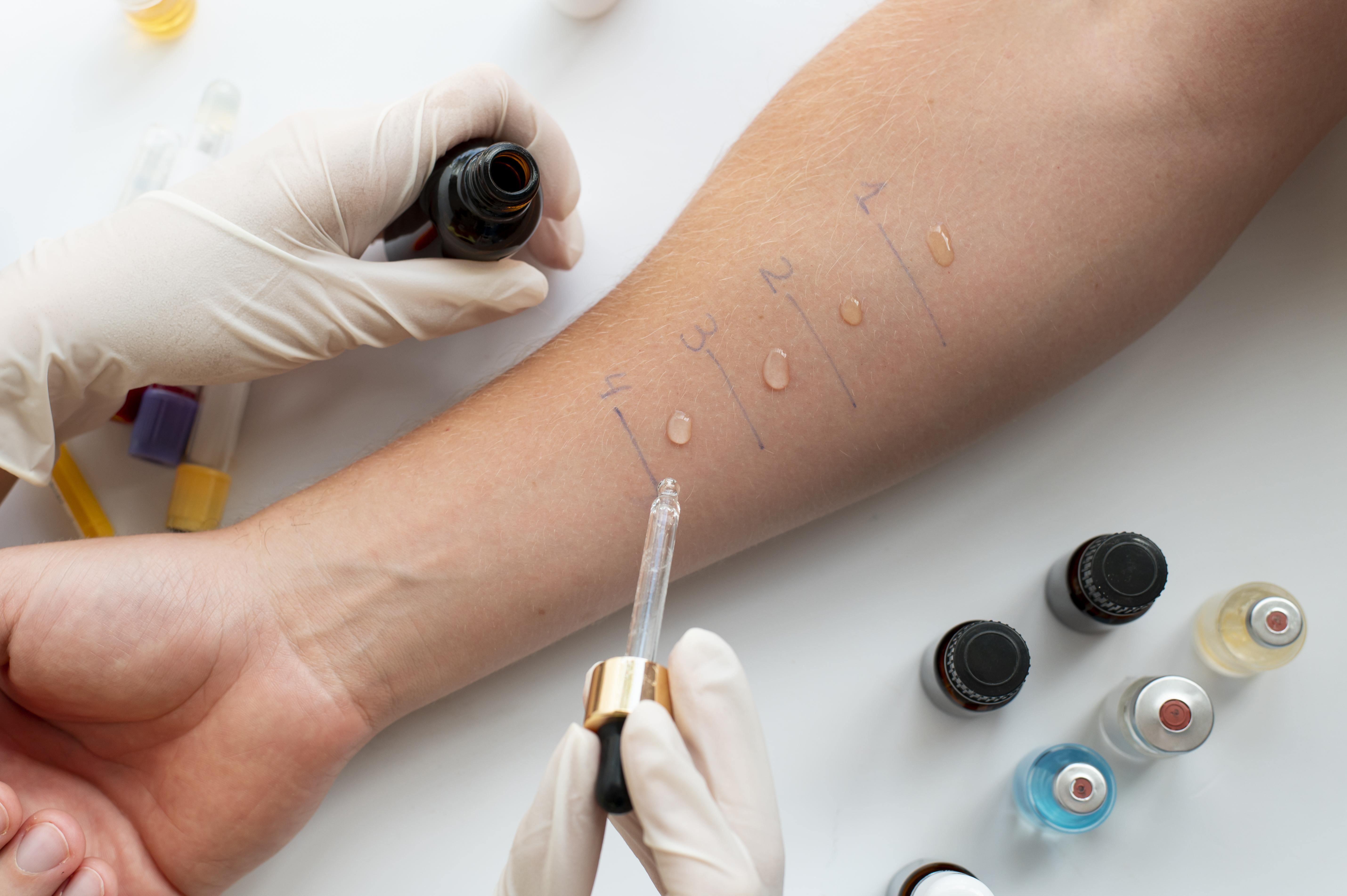 Allergy Panel Test